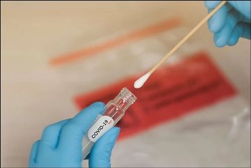 وش اسوي: ما هو فحص PCR؟ كيف يتمّ إجراؤه للكشف عن فيروس كورونا؟ وما هي تكلفته؟